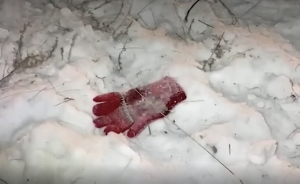 7-летнюю девочку загрызли собаки в Читинском районе