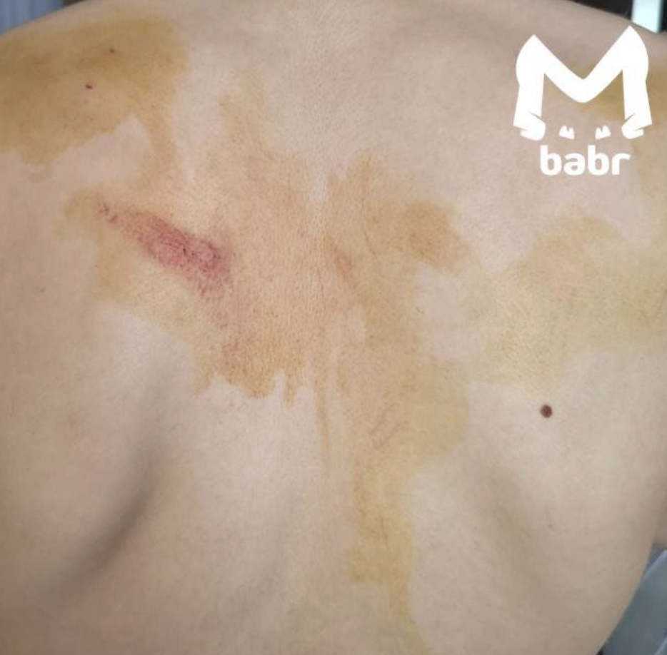 «Школьник из Бодайбо пришёл в поликлинику за справкой, а ушёл с царапинами»