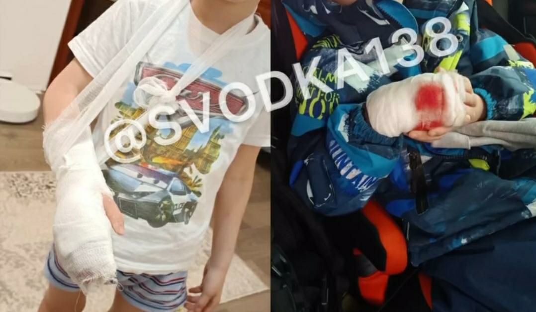 В микрорайоне Юбилейный на шестилетнего ребенка напали собаки