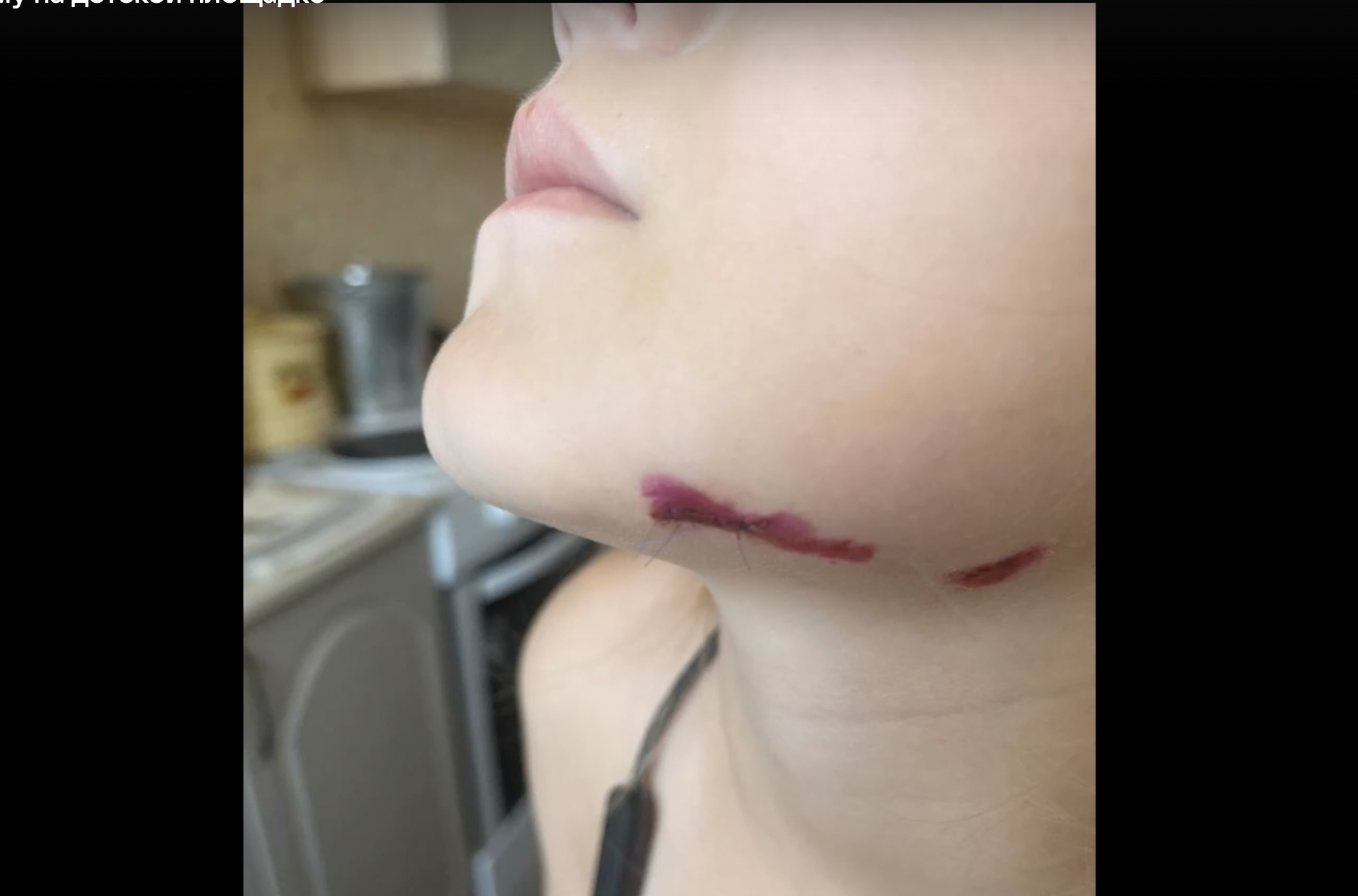 Девочка упала на торчащий штырь на детской площадке в Иркутске